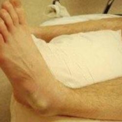 При подозрении на вывих в одном из суставов конечности запрещено