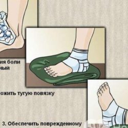 Первая помощь при ушибах повреждении мышц связок растяжение сухожилий