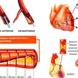 Боль в левом подреберье как при ушибе
