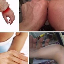 Если вы упали и ушибли ногу или руку нужно ответить