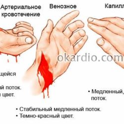 Первая медицинская помощь при кровотечениях и ушибах