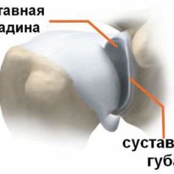 Назовите основную причину образования привычного вывиха плеча