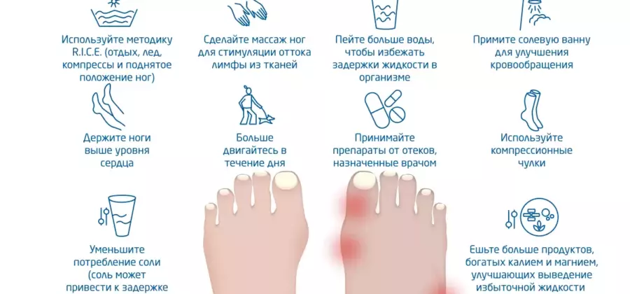Как снять отек со сломанной ноги в гипсе?