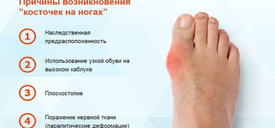 Воспаление косточки на ноге и отек поверхности
